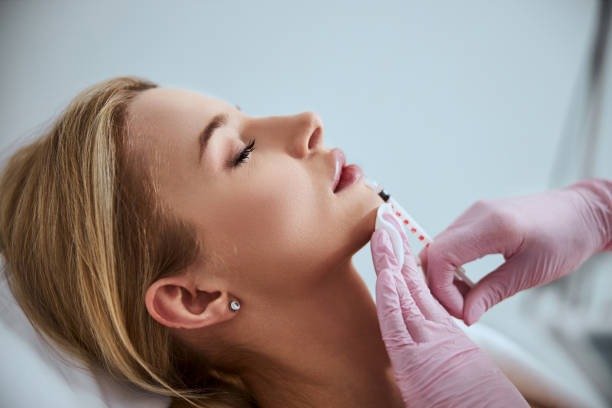 Sculptra vs. Traditional Dermal Fillers