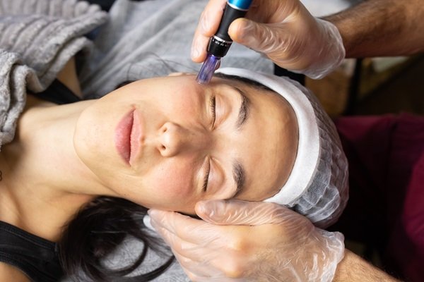 Dermal-Fillers-in-Malta