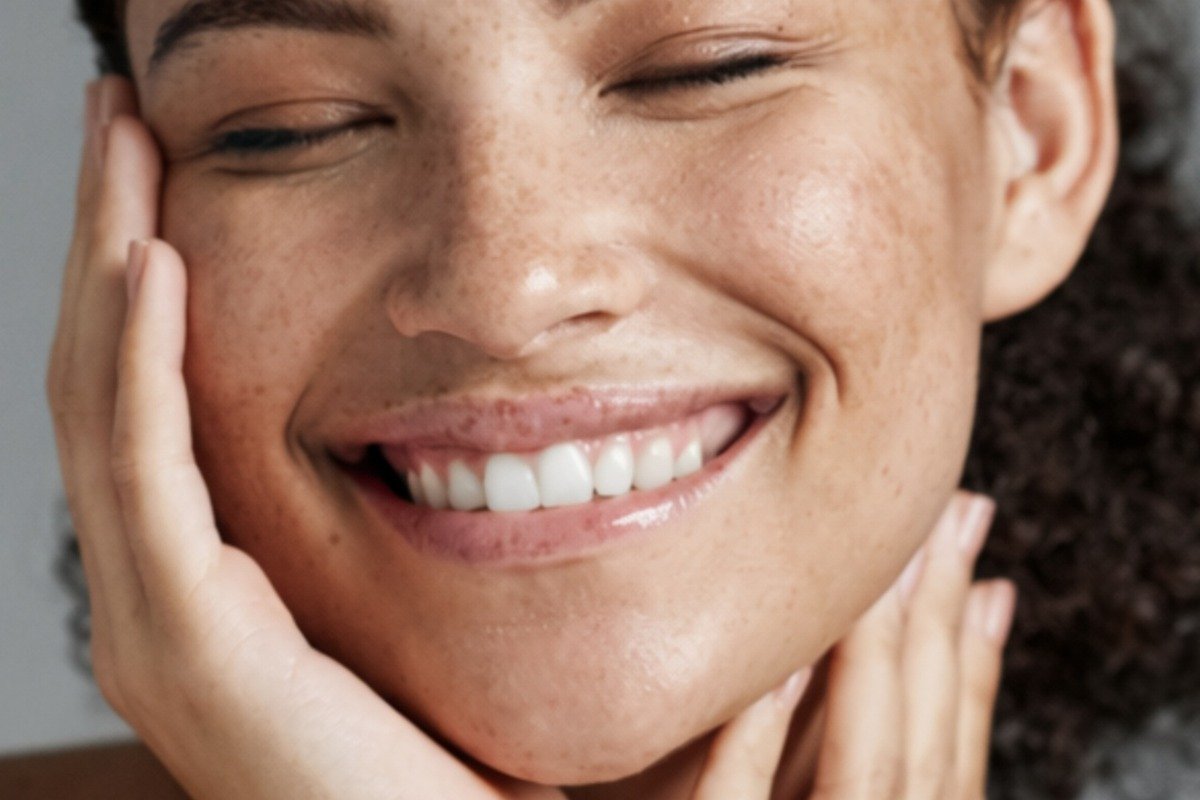 Melasma & Sun Pigmentation in Malta