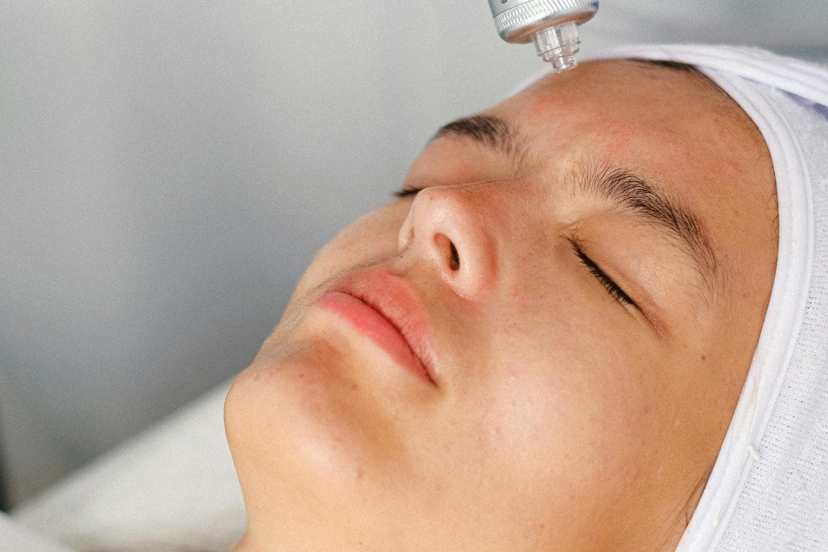 WhatsApp Image 2026-10-28 at 3.54 Melasma & Sun Pigmentation in Malta